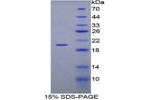 SDS-PAGE (SDS) image for Lymphotoxin-alpha (LTA) (AA 49-194) protein (His tag) (ABIN2127134)