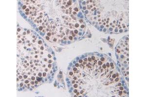 Used in DAB staining on fromalin fixed paraffin- embedded testis tissue (TRERF1 antibody  (AA 785-942))