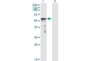 Western Blot analysis of SESN2 expression in transfected 293T cell line by SESN2 monoclonal antibody (M01), clone 1A12. (Sestrin 2 antibody  (AA 1-480))