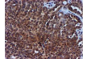Image no. 7 for anti-Metalloproteinase Inhibitor 2 (TIMP2) antibody (ABIN1501393)