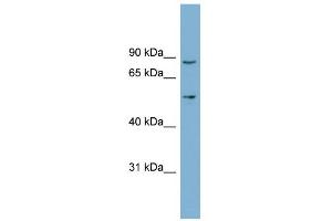 WB Suggested Anti-LRDD Antibody Titration: 0. (PIDD antibody  (Middle Region))