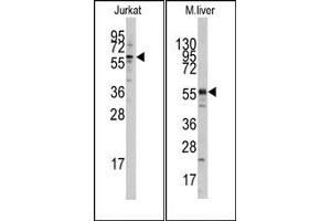 Image no. 1 for anti-K(lysine) Acetyltransferase 5 (KAT5) (N-Term) antibody (ABIN356624) (KAT5 antibody  (N-Term))