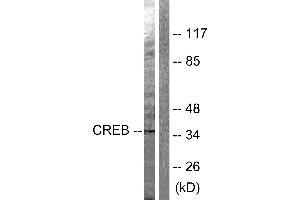 Western blot analysis of extracts from Hela cells treated with PMA (125ng/ml, 30min), using CREB (Ab-142) antibody (#B0006, Line 1 and 2). (CREB1 antibody  (Ser142))