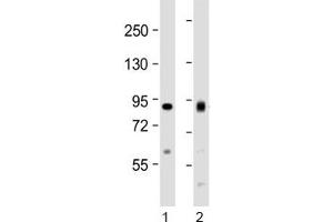 Western blot testing of human 1) HeLa and 2) Jurkat cell lysate with ACO2 antibody at 1:1000. (ACO2 antibody  (AA 294-325))