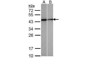 WB Image Sample(30 μg of whole cell lysate) A:A431, B:MOLT4, 12% SDS PAGE antibody diluted at 1:500