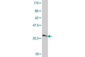 Western Blot detection against Immunogen (33. (PMM2 antibody  (AA 47-111))