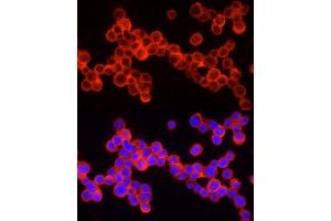 Immunofluorescence analysis of THP-1 cells using SHIP1 Rabbit pAb (ABIN3015068, ABIN3015069, ABIN6213623 and ABIN6213625) at dilution of 1:250 (40x lens). (INPP5D antibody  (AA 959-1188))