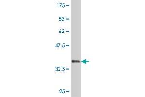 Western Blot detection against Immunogen (35. (MEOX1 antibody  (AA 82-170))