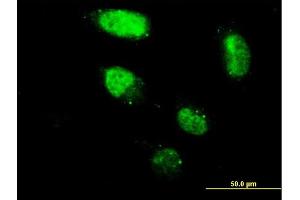 Immunofluorescence of monoclonal antibody to ZNF213 on HeLa cell. (ZNF213 antibody  (AA 133-242))