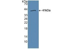 Detection of Recombinant TLR9, Human using Polyclonal Antibody to Toll Like Receptor 9 (TLR9) (TLR9 antibody  (AA 28-362))