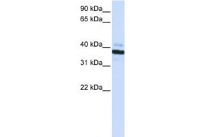 WB Suggested Anti-OAS1 Antibody Titration:  0. (OAS1 antibody  (C-Term))
