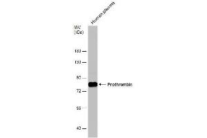 WB Image Human tissue extract (30 μg) was separated by 7. (Prothrombin antibody  (N-Term))
