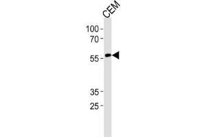 Western Blotting (WB) image for anti-Runt-Related Transcription Factor 2 (RUNX2) antibody (ABIN3003461) (RUNX2 antibody)