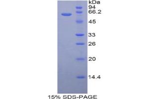 SDS-PAGE analysis of Mouse HSD17b12 Protein. (HSD17B12 Protein)