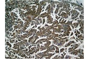 Immunohistochemistry (IHC) image for anti-Nuclear Factor-kB p65 (NFkBP65) (pSer536) antibody (ABIN7138649)