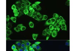 Immunofluorescence analysis of HeLa cells using Phospho-mTOR(S2448) Polyclonal Antibody at dilution of 1:100. (MTOR antibody  (pSer2448))
