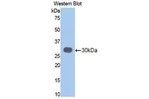 Western blot analysis of the recombinant protein. (Elastase 3B antibody  (AA 28-267))