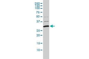 COMT monoclonal antibody (M01), clone 1G4-1A1 Western Blot analysis of COMT expression in A-431 . (COMT antibody  (AA 1-182))