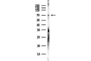 Western blot analysis of lysates from COLO205 cells(heat-shock,45 min treatment), using CMG1 Antibody at 1/1000 dilution.