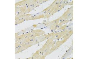 Immunohistochemistry of paraffin-embedded rat heart using TRAP1 Antibody (ABIN5971463) at dilution of 1/100 (40x lens). (TRAP1 antibody)