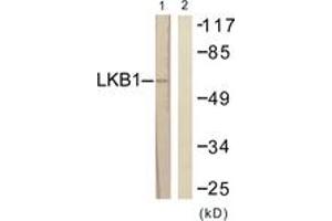 Western blot analysis of extracts from HeLa cells, treated with Serum 20% 15', using LKB1 (Ab-189) Antibody. (LKB1 antibody  (AA 155-204))