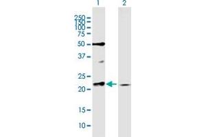 Western Blot analysis of RAB11A expression in transfected 293T cell line by RAB11A MaxPab polyclonal antibody. (RAB11A antibody  (AA 1-216))