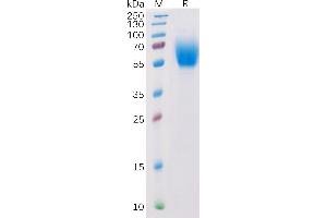 SDS-PAGE (SDS) image for Interleukin 13 Receptor, alpha 1 (IL13RA1) (AA 23-343) protein (His tag) (ABIN6964113)