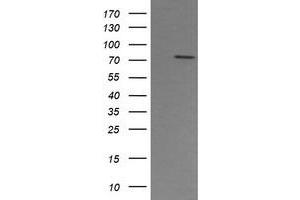 Image no. 1 for anti-Peptidyl Arginine Deiminase, Type IV (PADI4) (AA 299-588) antibody (ABIN1491357) (PAD4 antibody  (AA 299-588))
