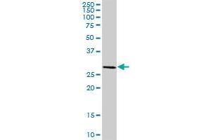 HSD17B8 MaxPab polyclonal antibody. (HSD17B8 antibody  (AA 1-261))