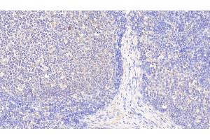 Detection of S100Z in Human Lymph node Tissue using Polyclonal Antibody to S100 Calcium Binding Protein Z (S100Z)