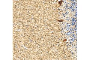 anti-Glutamate Receptor, Ionotropic, delta 2 (GRID2) (N-Term) antibody