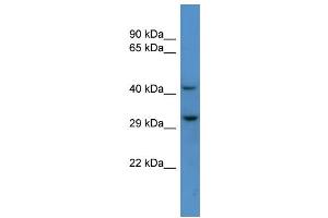 Host: Rabbit Target Name: TXNIP Sample Type: Jurkat Whole Cell lysates Antibody Dilution: 1.
