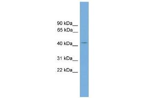 WB Suggested Anti-AP1M2 Antibody Titration: 0. (AP1m2 antibody  (N-Term))
