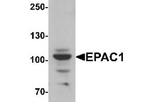 Western blot analysis of EPAC1 in rat skeletal muscle tissue lysate with EPAC1 antibody at 1 µg/mL.