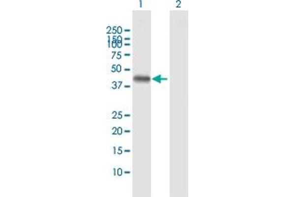 LECT1 抗体  (AA 1-334)