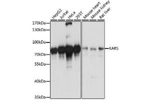 Western blot analysis of extracts of various cell lines, using KARS antibody. (KARS antibody  (AA 298-597))