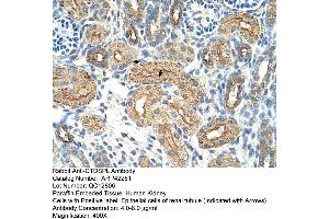 Rabbit Anti-CTDSPL Antibody  Paraffin Embedded Tissue: Human Kidney Cellular Data: Epithelial cells of renal tubule Antibody Concentration: 4. (CTDSPL antibody  (N-Term))