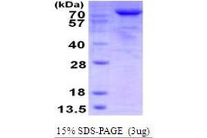 SDS-PAGE (SDS) image for threonyl-tRNA Synthetase (TARS) (AA 1-723) protein (His tag) (ABIN7279712) (TARS Protein (AA 1-723) (His tag))