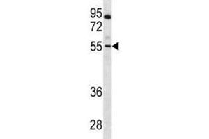 PAX7 antibody western blot analysis in CEM lysate (PAX7 antibody  (AA 181-210))