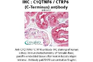 Image no. 2 for anti-Complement C1q Tumor Necrosis Factor-Related Protein 6 (C1QTNF6) antibody (ABIN1732486) (CTRP6 antibody)