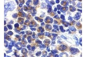 Immunohistochemistry of DAPK2 in mouse spleen cells with DAPK2 antibody at 2 μg/ml. (DAPK2 antibody)
