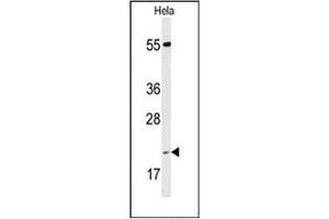 Western blot analysis of PPIC Antibody (Center) in Hela cell line lysates (35ug/lane). (PPIC antibody  (Middle Region))
