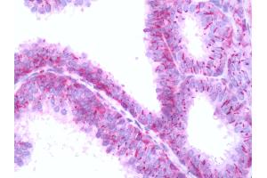 Human Seminal Vesicle: Formalin-Fixed, Paraffin-Embedded (FFPE) (Mu Opioid Receptor 1 antibody  (Extracellular Domain))