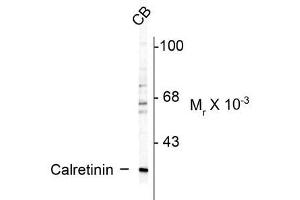 Western blots of rat cerebellum (CB) lysate showing specific immunolabeling of the ~ 29k calretinin protein. (Calretinin antibody)