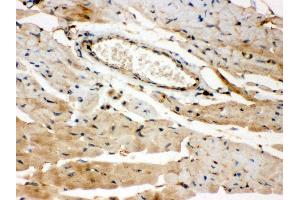 Anti- ROCK2 Picoband antibody,IHC(P) IHC(P): Mouse Cardiac Muscle Tissue (ROCK2 antibody  (AA 652-923))