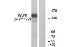 Western blot analysis of extracts from A431 cells treated with EGF 40 muM 10', using EGFR (Phospho-Tyr1172) Antibody. (EGFR antibody  (pTyr1172))