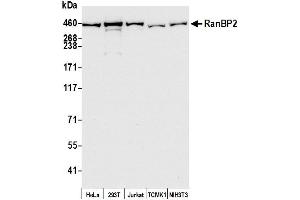 anti-RAN Binding Protein 2 (RANBP2) (AA 1050-1100) antibody