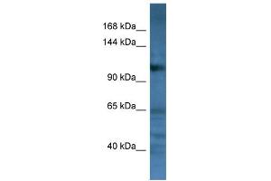 WB Suggested Anti-CD22 Antibody Titration: 0. (CD22 antibody  (C-Term))