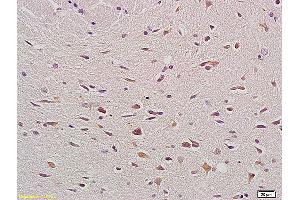 Formalin-fixed and paraffin embedded rat brain labeled with Anti- Bax Polyclonal Antibody, Unconjugated (ABIN725375) at 1:200, followed by conjugation to the secondary antibody and DAB staining.