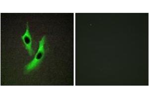 Immunofluorescence analysis of HeLa cells, using STEAP4 Antibody.